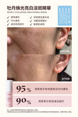 PEONY+ HYALURONIC BRIGHTENING SERUM (30ml)