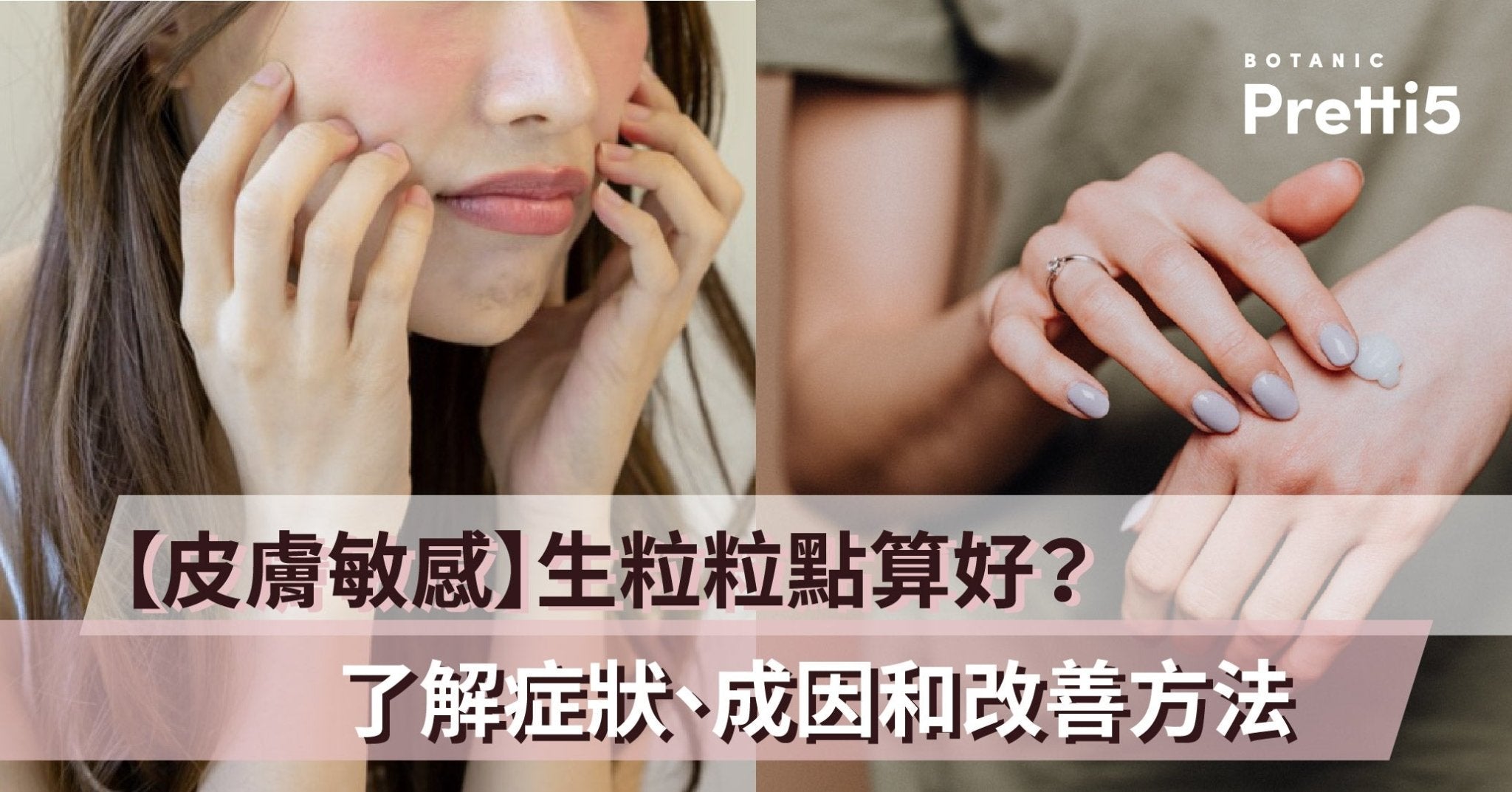 【皮膚敏感】生粒粒點算好？了解症狀、成因和改善方法 - Pretti5 - HK
