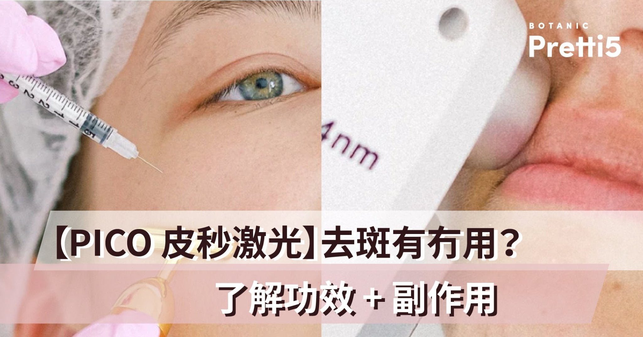 【Pico 皮秒激光】去斑有冇用？了解功效 + 副作用 - Pretti5 - HK