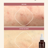 PEPTIDE＋ LICORICE BARRIER REPAIR SERUM