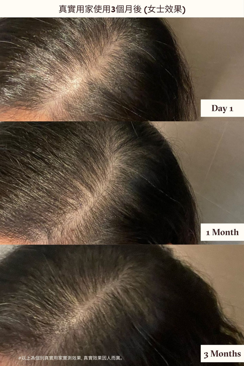 3-MONTH ROOT REVIVE & HAIR GLOWING SET