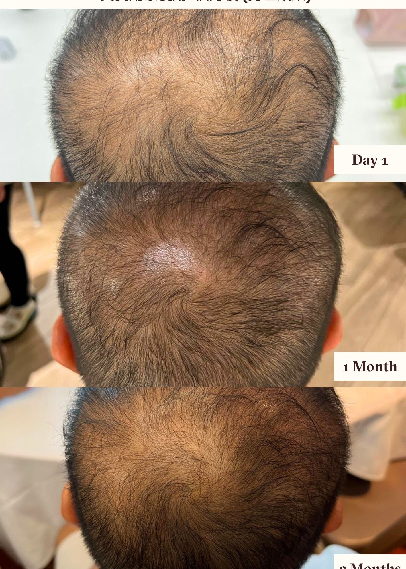 Hair Serum After 3 Months