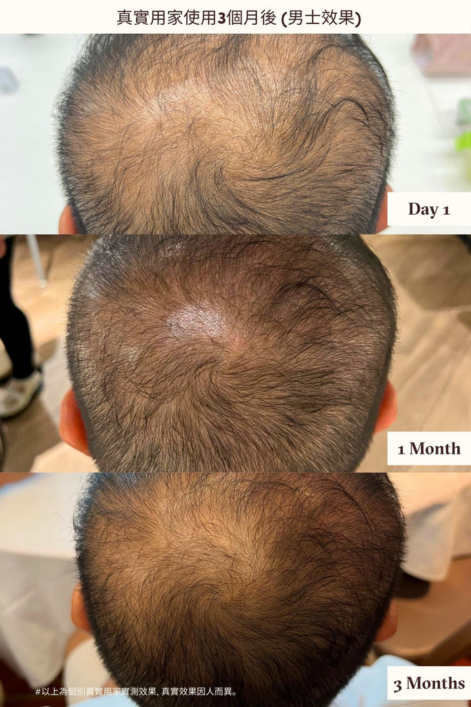 Hair Serum After 3 Months