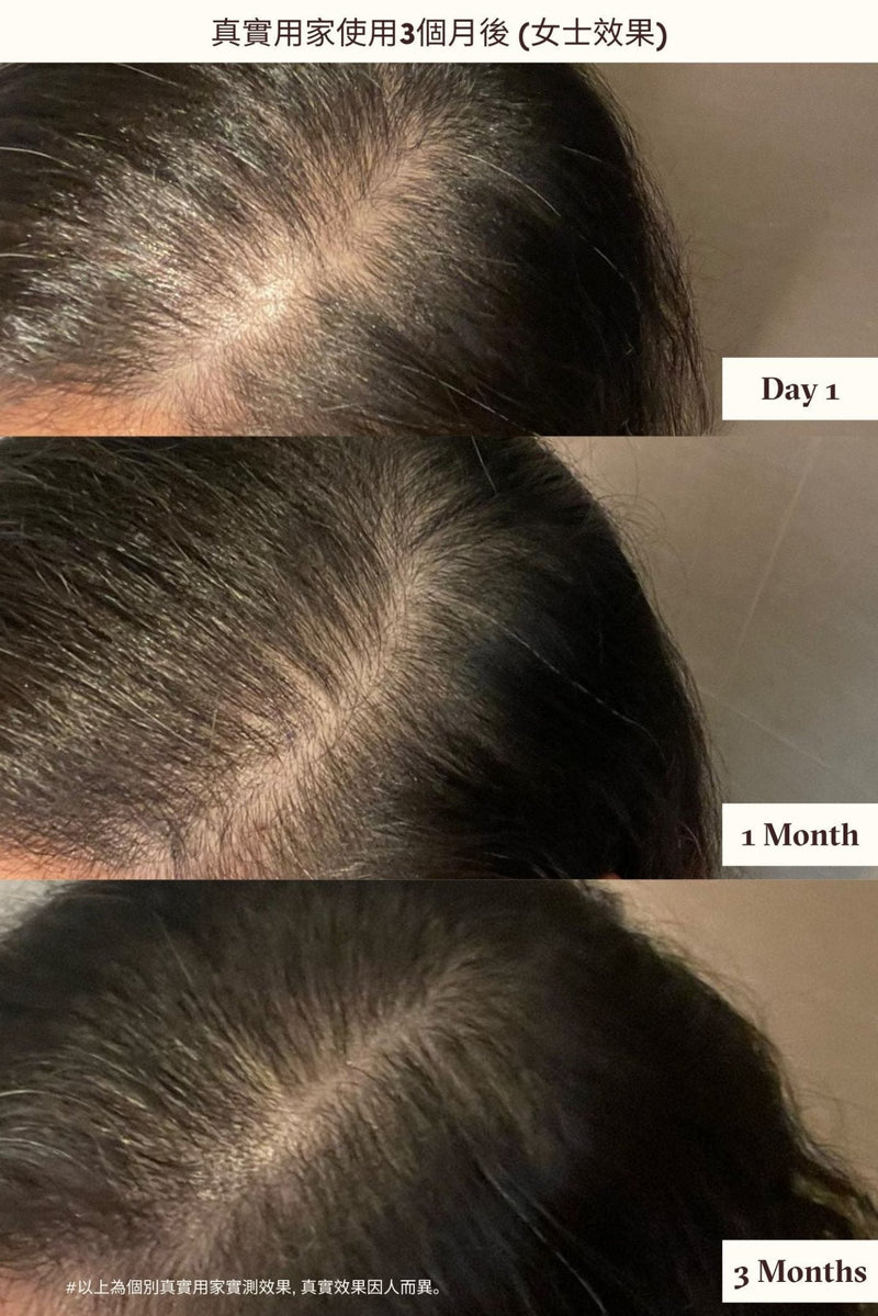 KKF ROOTING FOR YOUR HAIR SERUM - Pretti5 - HK
