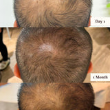 ROOTING FOR YOUR HAIR SERUM - Pretti5 - HK