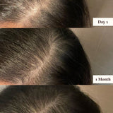 ROOTING FOR YOUR HAIR SERUM - Pretti5 - HK