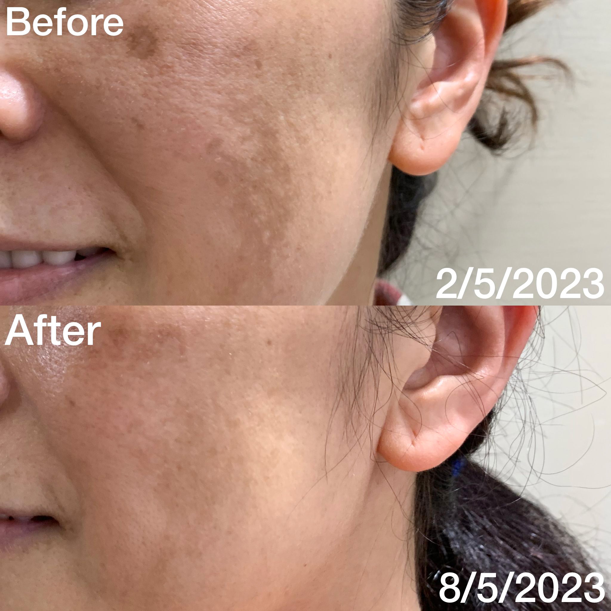 PEONY+ HYALURONIC BRIGHTENING SERUM (28ml) - Pretti5 - TCM-Infused Clean Beauty For Natural Glow