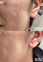 PEONY+ HYALURONIC BRIGHTENING SERUM (28ml) - Pretti5 - TCM-Infused Clean Beauty For Natural Glow